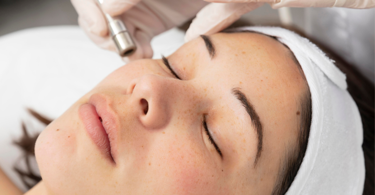 Paciente realizando tratamiento de microdermoabrasión