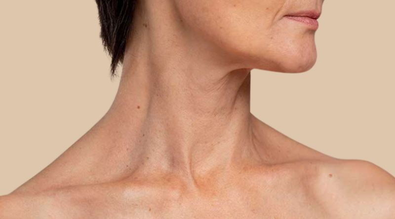 BLOG - IMAGEN - 800X500px (23)