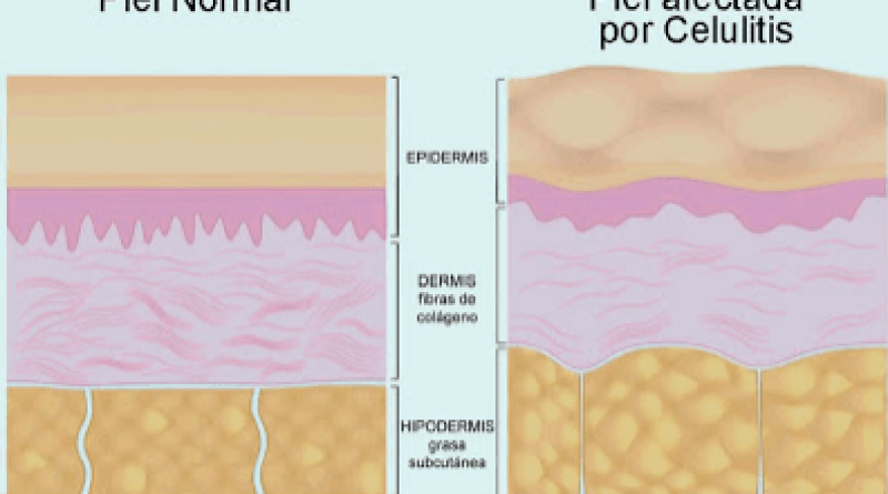 captura-de-pantalla-2017-04-06-a-las-13-37-14