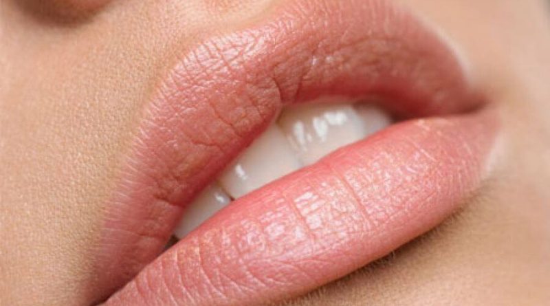 cido-hialurnico-labios