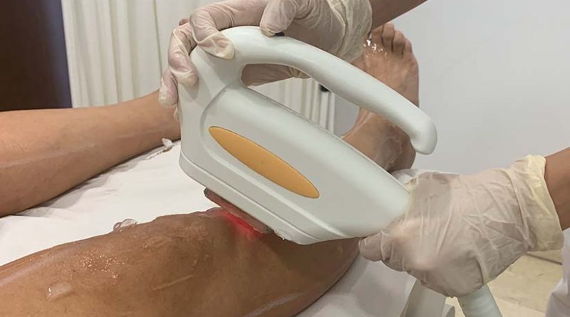 depilacion-laser-clinicas-dh-alejandrita-diodo-soprano