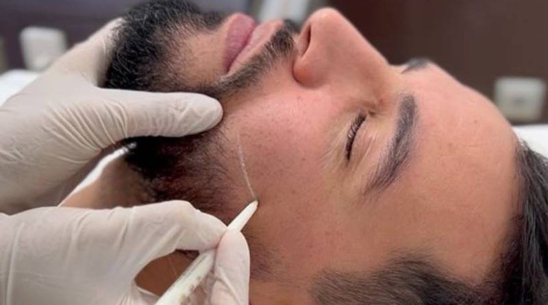 depilacion-laser-para-hombres-clinicas-dh