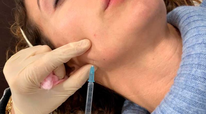 mesoterapia-facial-clinicas-dh