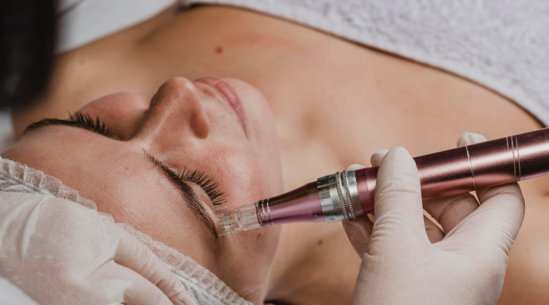 microdermoabrasion-punta-de-diamante-dh