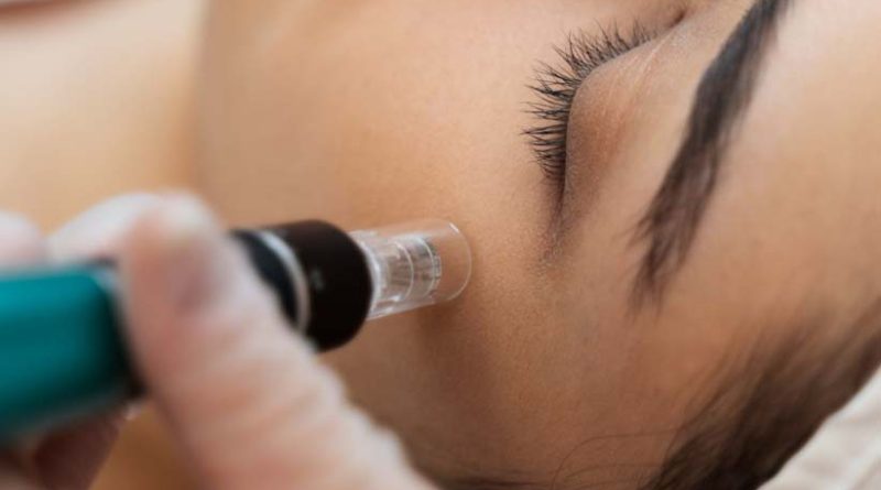 mitos-y-realidades-sobre-el-dermapunt-facial