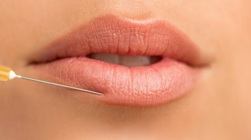 preguntas-frecuentes-aumento-de-labios-clinicasdh