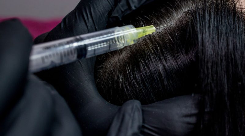 renueva-cabello-bio-estimulacion-capilar-clinicas-dh